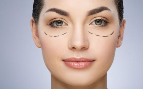 blefaroplastia