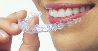 Invisalign deportistas