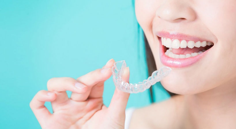 Ortodoncia Invisalign para deportistas