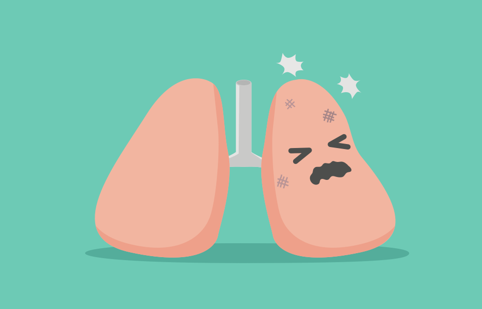 Enfermedad Pulmonar Obstructiva Cronica