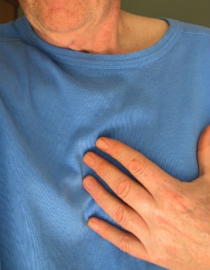Que es el infarto de miocardio