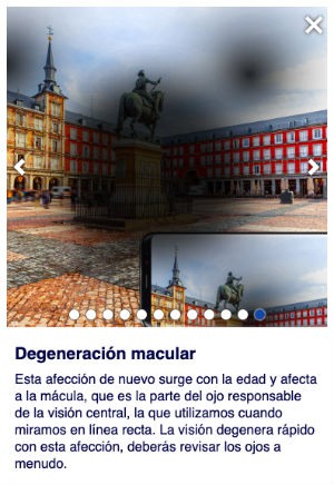 Degeneracion macular