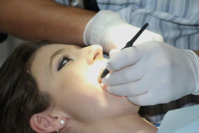 Causas para ir al dentista de urgencia