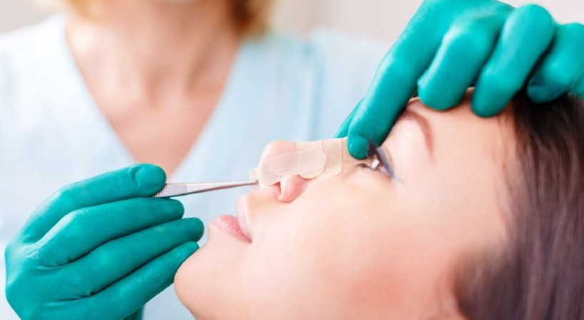 Rinoplastia