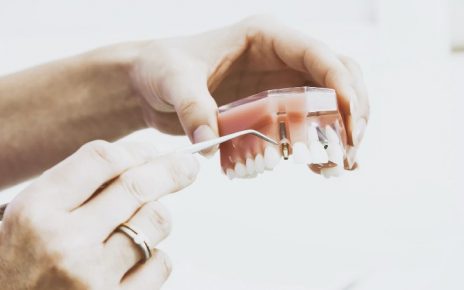 Prótesis dental