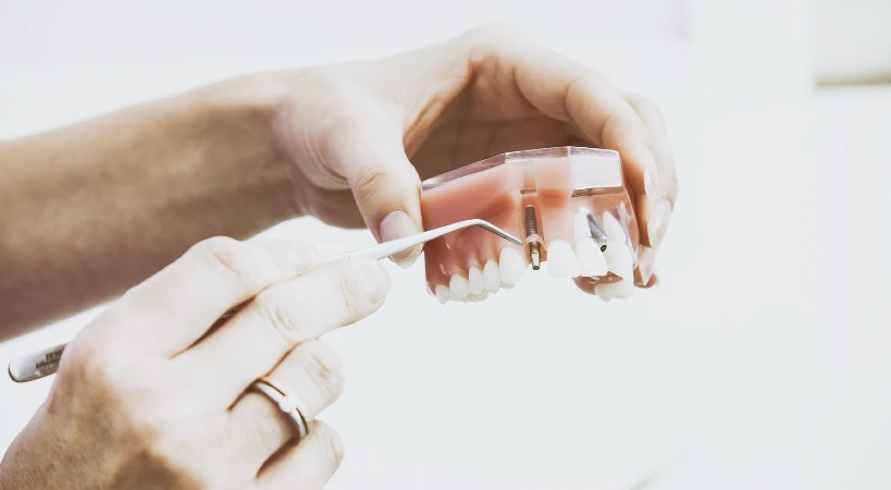 Prótesis dental