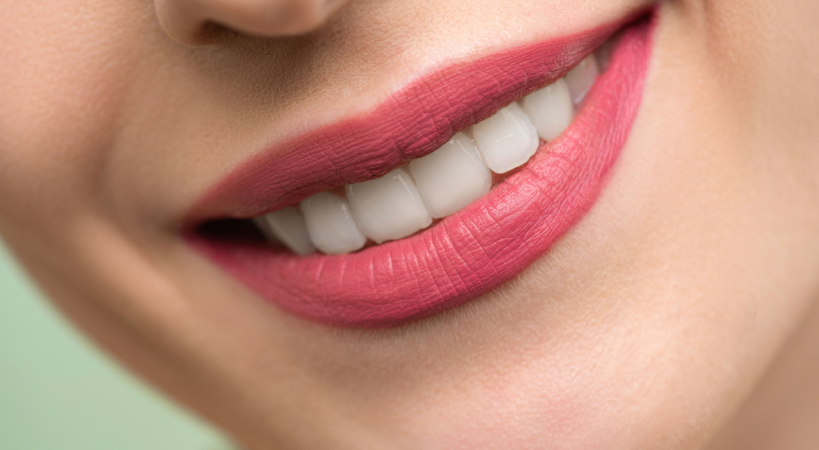 Sonrisa